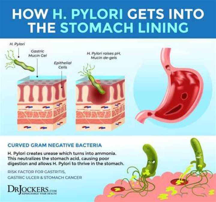 Can you eradicate H. pylori naturally?