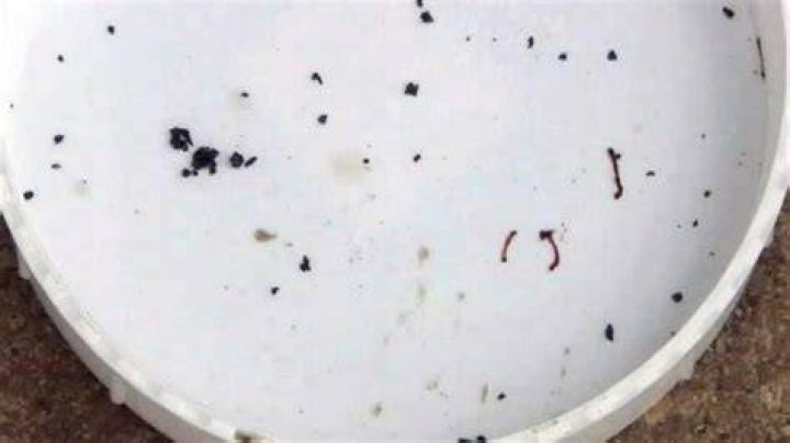 Can you get worms from water?
