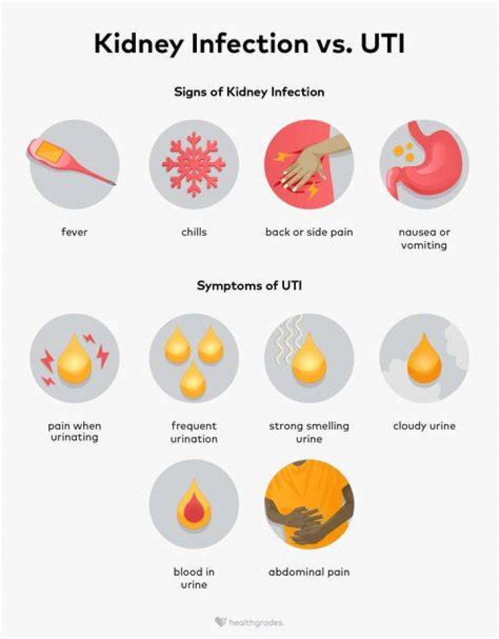 Can you have a kidney infection without pain when urinating?