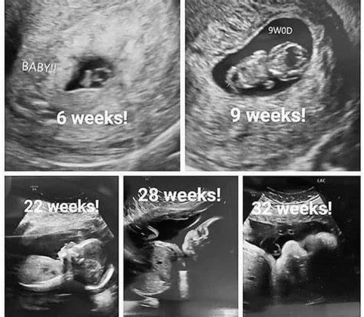 Can you have an ultrasound every week?