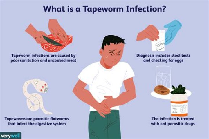 Can you pull out a tapeworm?