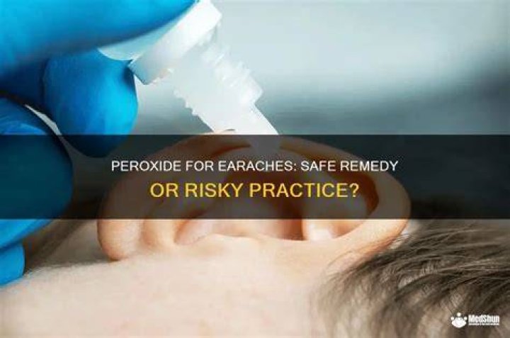 Can you put peroxide in your ear for earache?