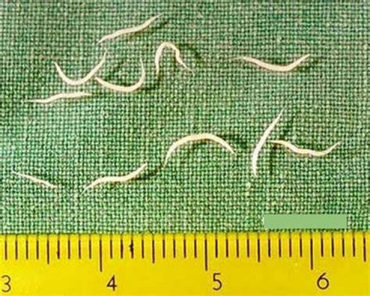 Can you see pinworms in poop?