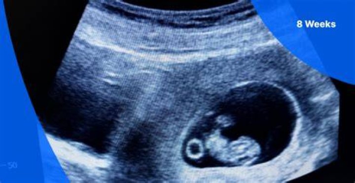 Can you show at 8 weeks?