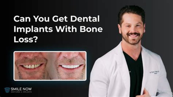 Can you still get dentures with bone loss?