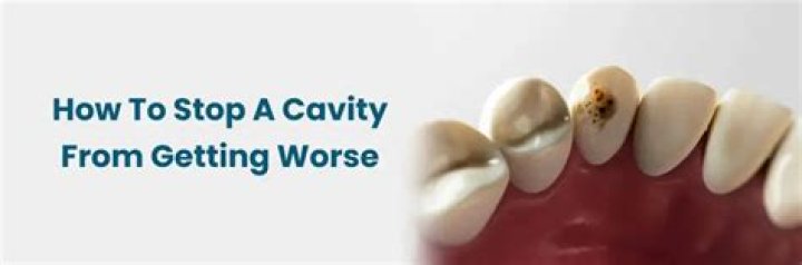 Can you stop cavities from worsening?