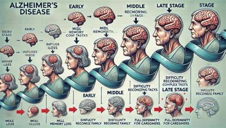 Can you tell if someone has Alzheimer's by looking at their eyes?