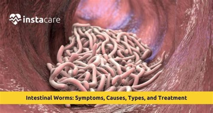 Can you test for worms in humans?