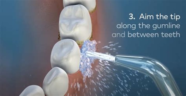 Can you use a WaterPik to clean your ears?