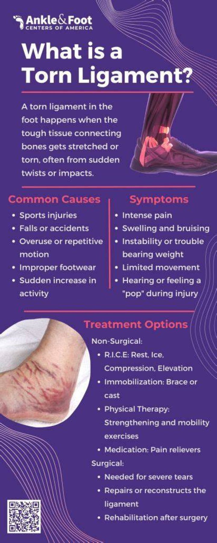 Can you walk on a torn ankle ligament?