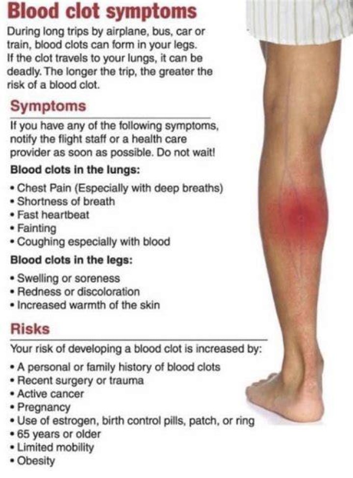 Can you walk with a blood clot in your leg?