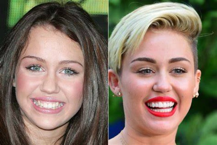 Do all celebrities get their teeth fixed?