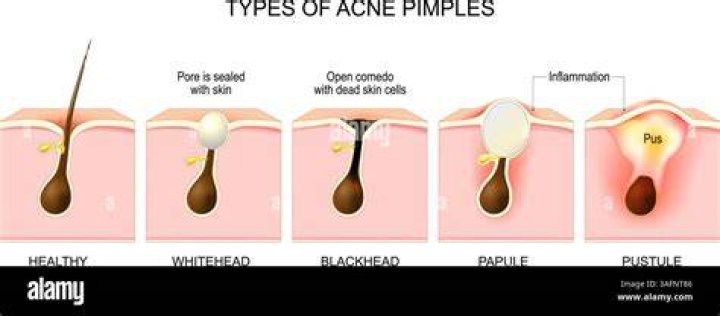 Do all pores have hair?