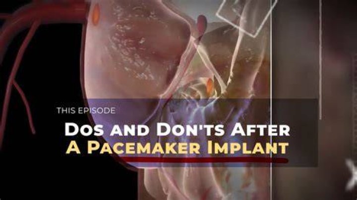 Do and don'ts with pacemaker?