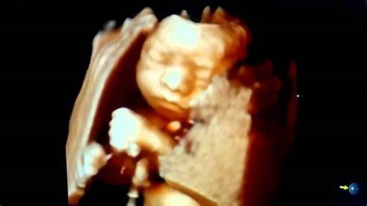 Do babies open their mouth in the womb?