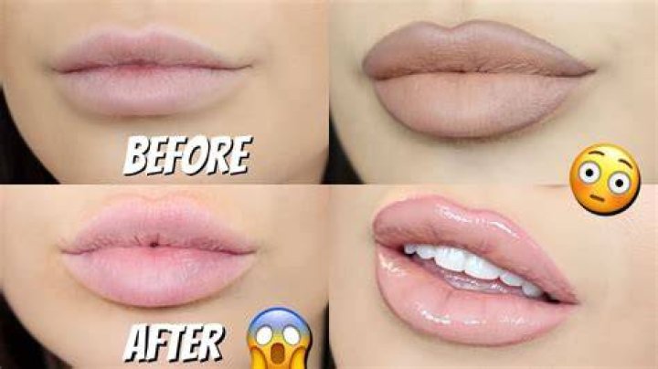 Do bigger lips make you look better?