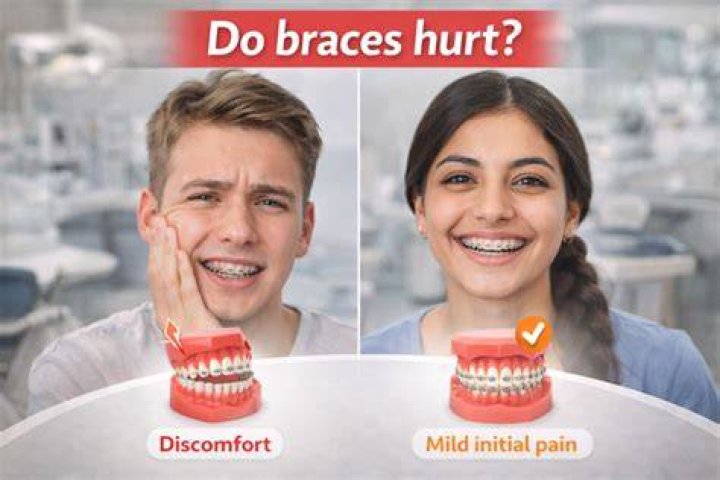 Do braces hurt a lot?