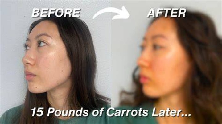 Do carrots make you tan faster?