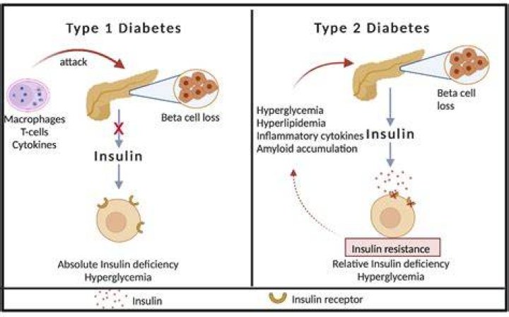 Do diabetics have a weakened immune system?