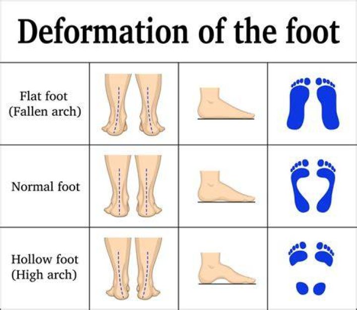 Do flat-footed people jump lower?