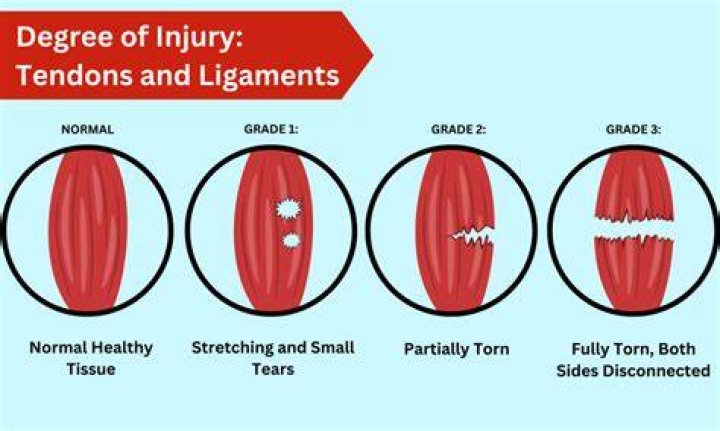 Do grade 3 ligament tears need surgery?
