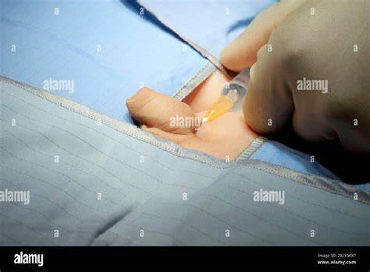 Do hospitals sell foreskin?
