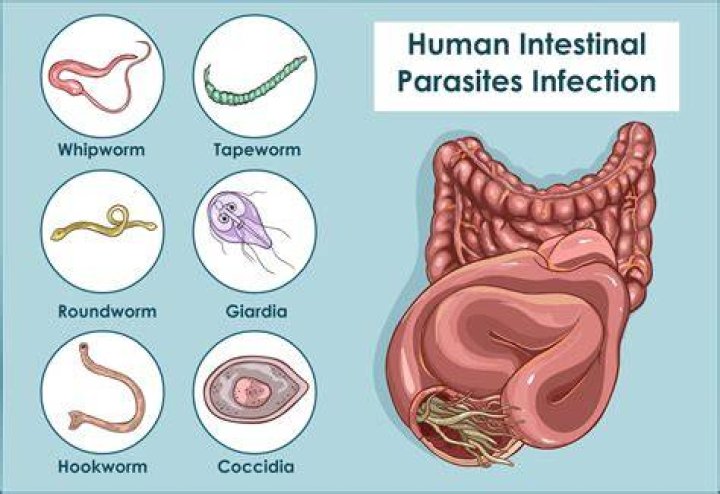 Do human naturally have worms?