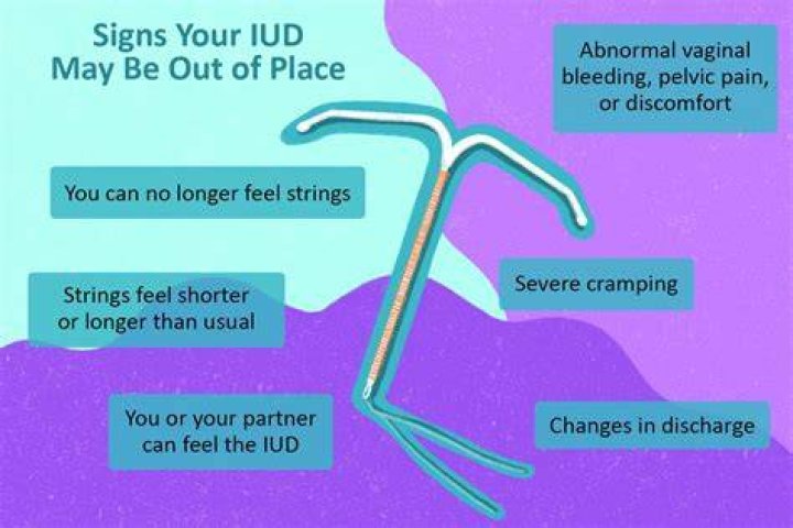 Do IUDs have less side effects than the pill?