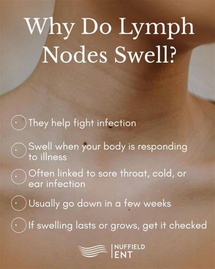 Do lymph nodes swell before you get sick?