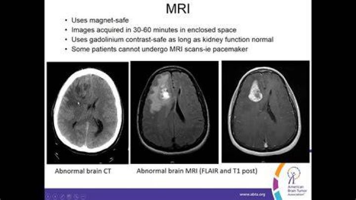 Do tumors show up on MRI?