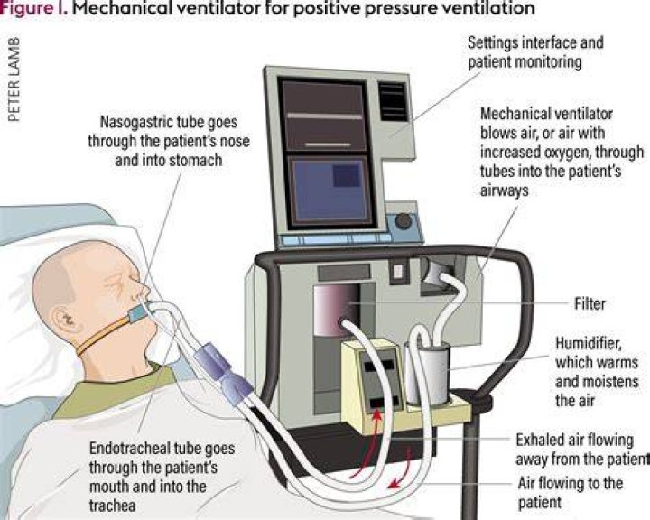 Do ventilators go down your throat?