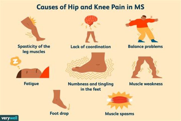 Do you get hip pain with MS?