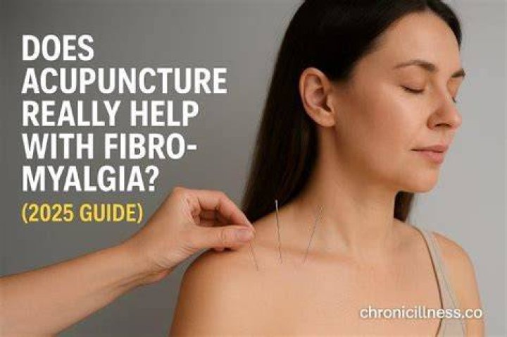 Does acupuncture help fibromyalgia?