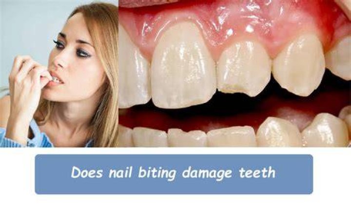 Does Clorox damage teeth?