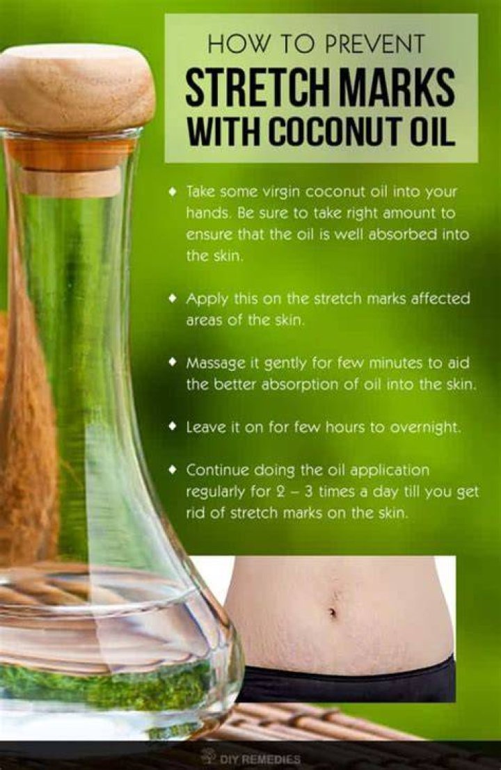Does coconut oil prevent stretch marks?