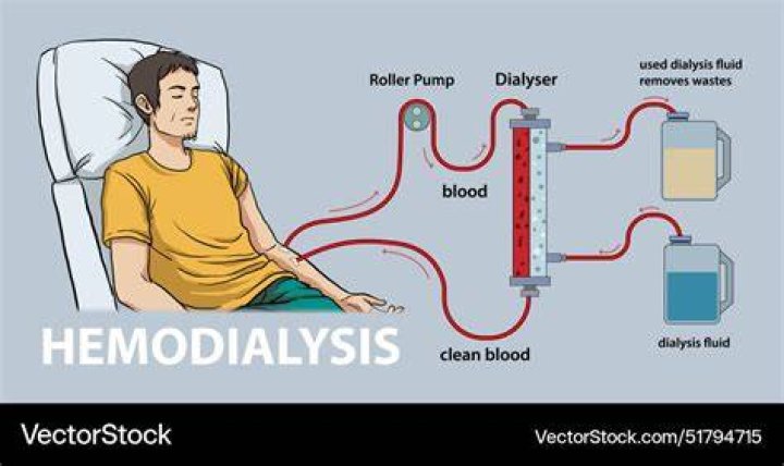 Does dialysis remove water from lungs?