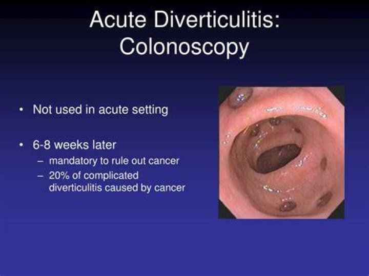 Does diverticulitis show up on colonoscopy?