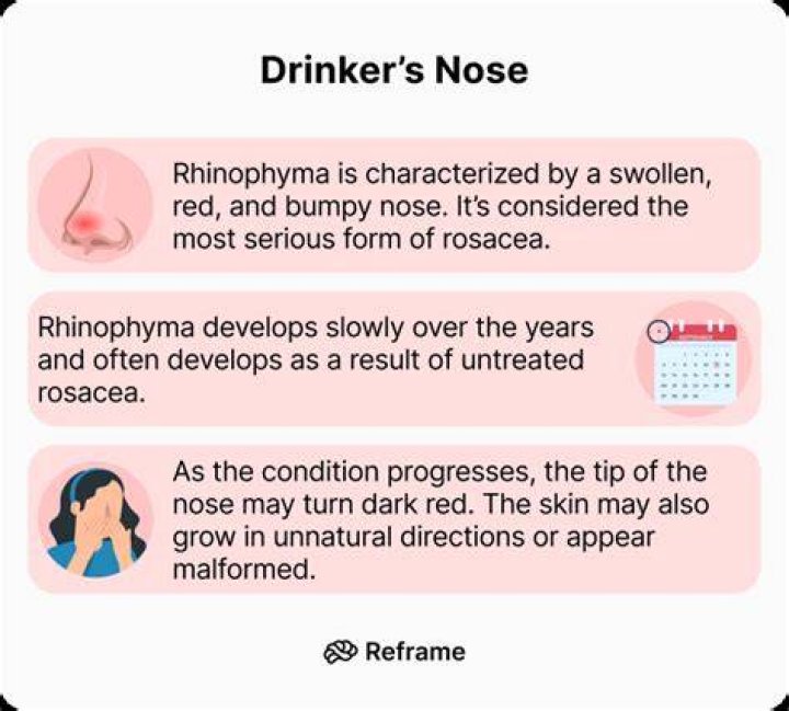 Does drinking alcohol make your nose bigger?