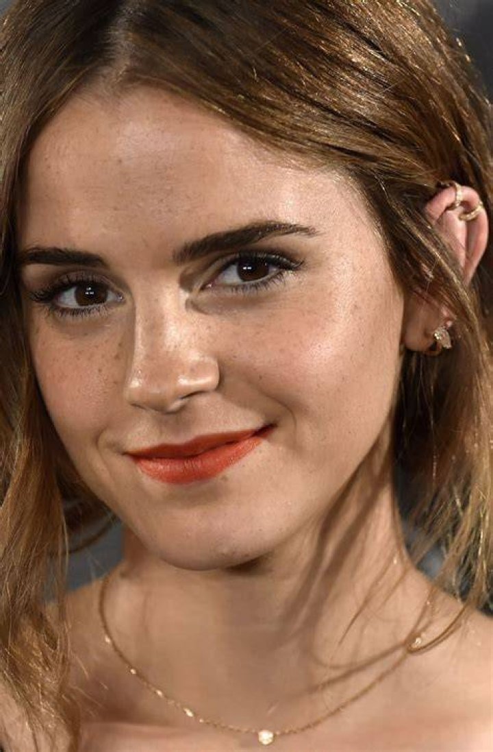 Does Emma Watson have natural freckles?