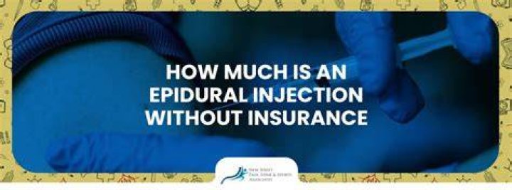 Does epidural cost extra?