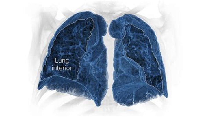 Does fiberglass stay in your lungs forever?