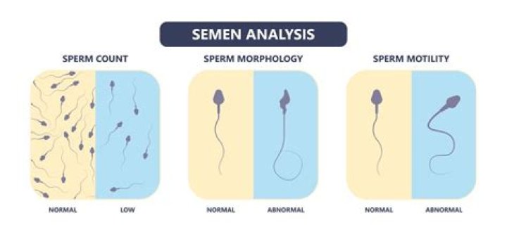 Does flying affect sperm quality?