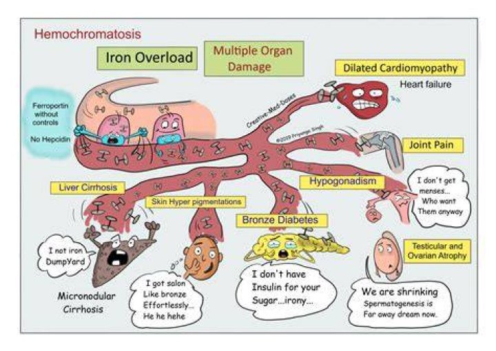 Does hemochromatosis affect memory?