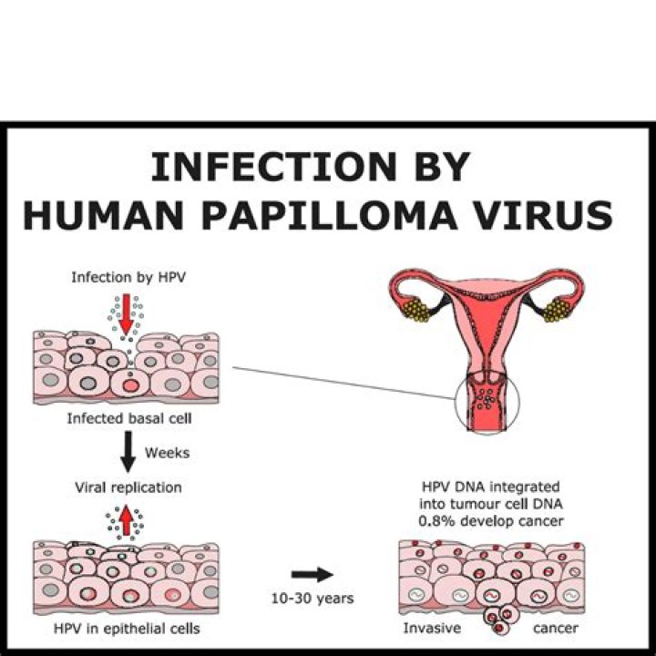 Does HPV have discharge?