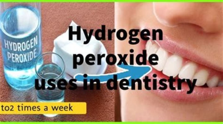 Does hydrogen peroxide get rid of plaque?