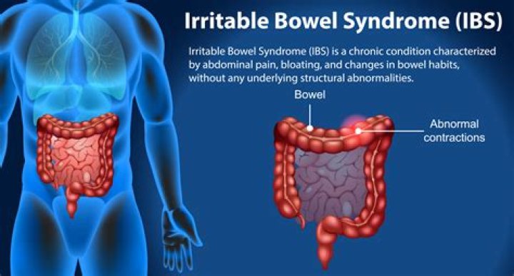 Does IBS shorten your life?