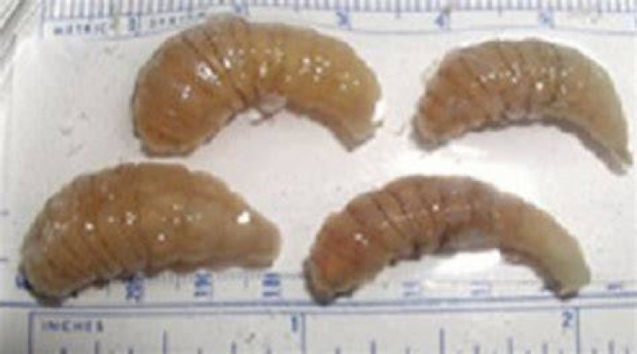 Does intestinal myiasis go away?