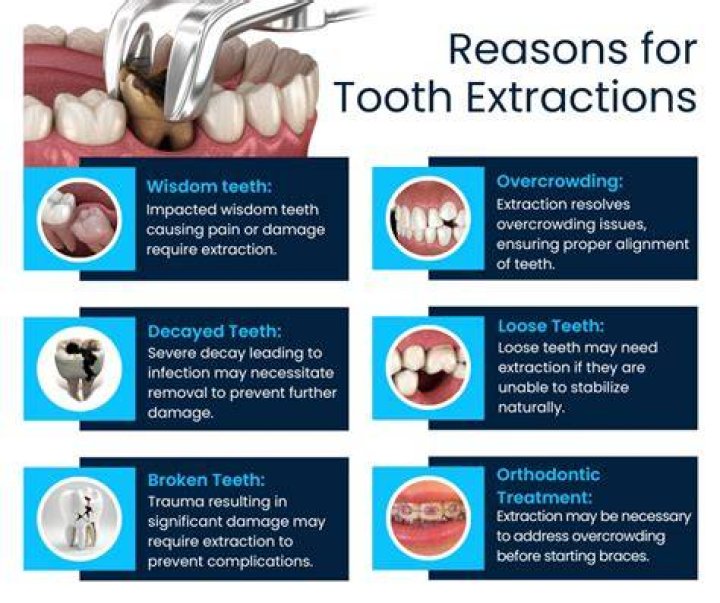 Does it hurt to get a tooth pulled?