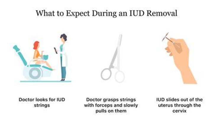 Does IUD removal hurt?