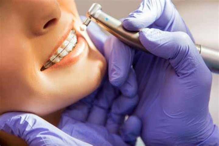 Does orthodontist do cleaning?